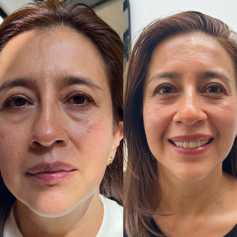 Membresía Reflexología Facial para Todos los Males