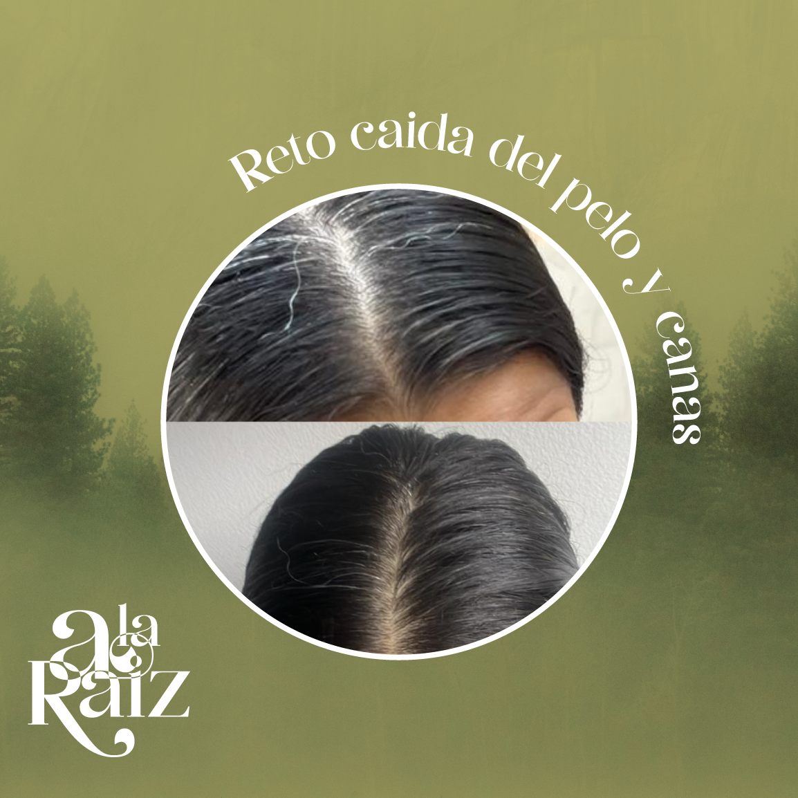 Reto de 30 dias para frenar la caida del pelo y canas con reflexologia facial