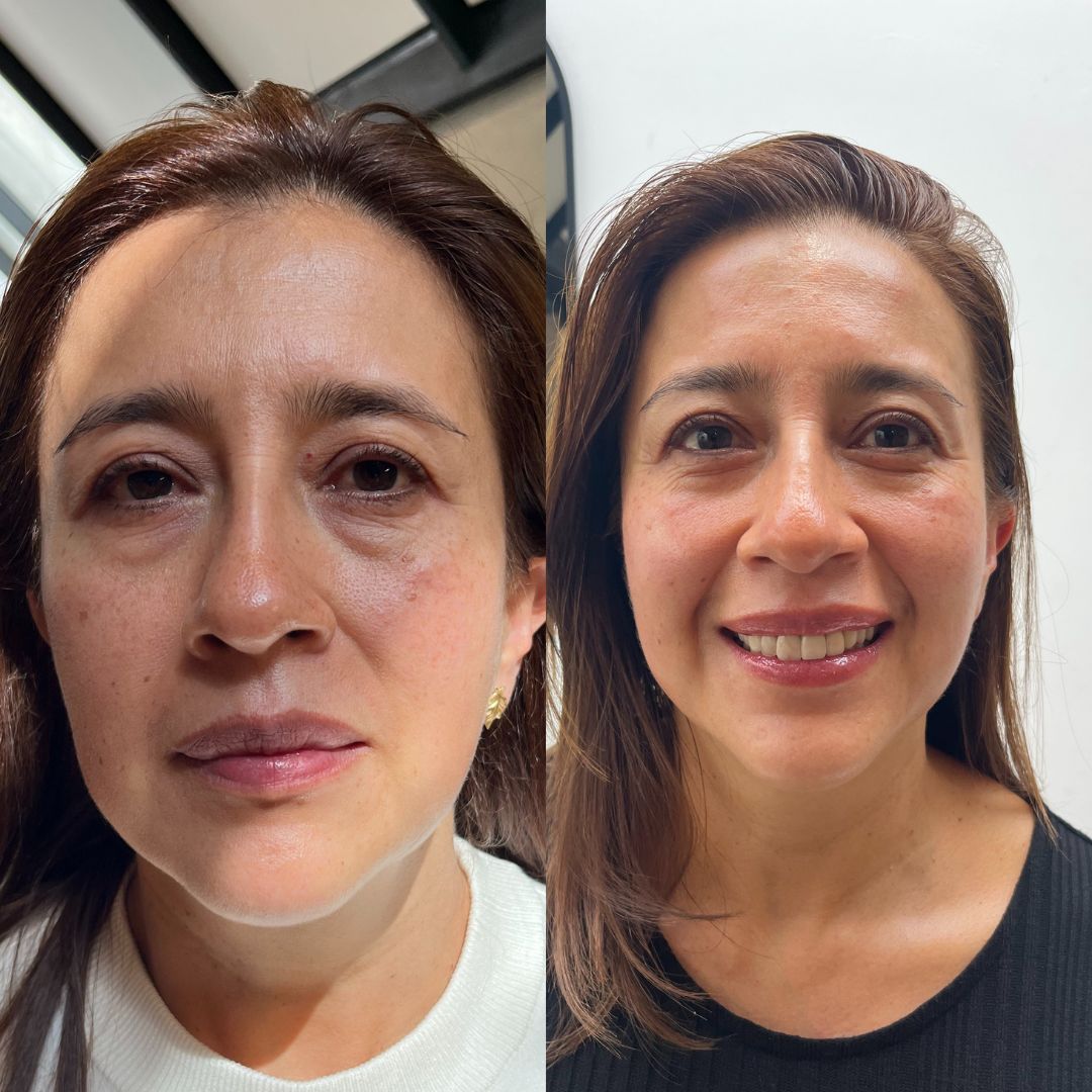 Programa reflexologia para todos los males